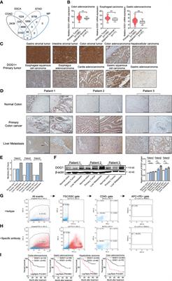 DOG1 as a novel antibody-drug conjugate target for the treatment of multiple gastrointestinal tumors and liver metastasis